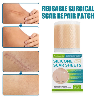 Silicone Scar Sheets